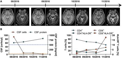 An Enigmatic Case of Acute Mercury Poisoning: Clinical, Immunological Findings and Platelet Function